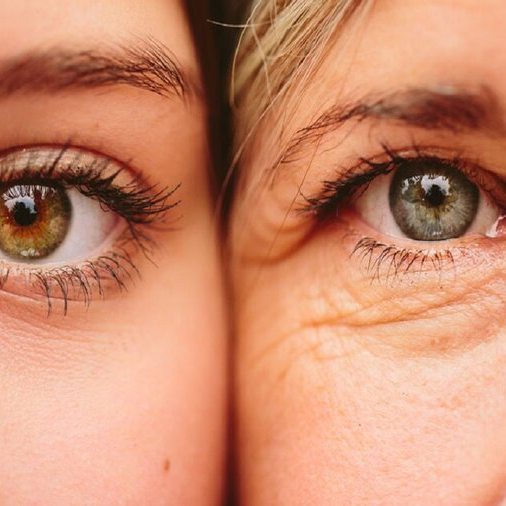 ۶ درمان خانگی که برای رفع چروک دور چشم معجزه می‌کنند