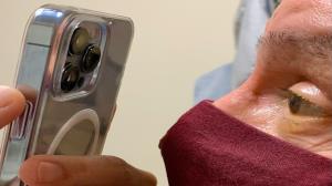 آیفون ۱۳ پرو تبدیل به ابزار پزشکی برای معاینه چشم شد