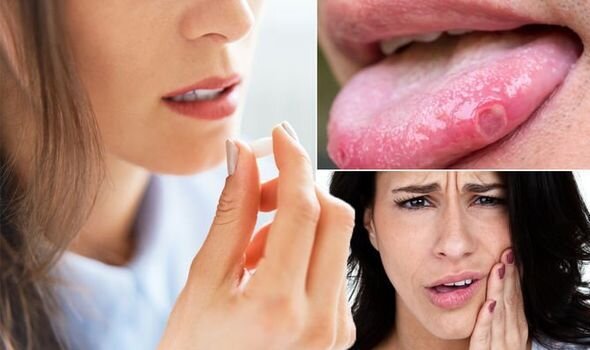 چگونه زخم‌های دهان را درمان کنیم؟