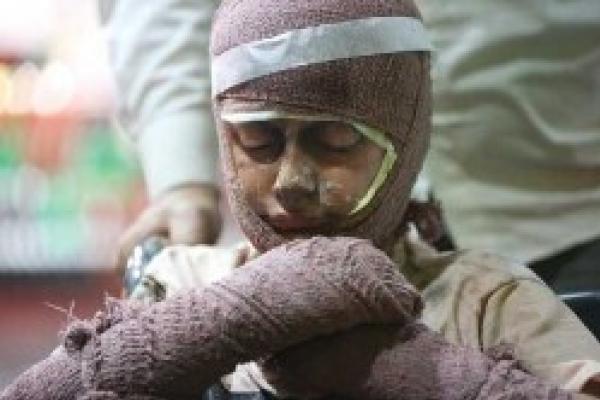 فوت ۸۱ نفر به‌دنبال سوختگی در استان اصفهان