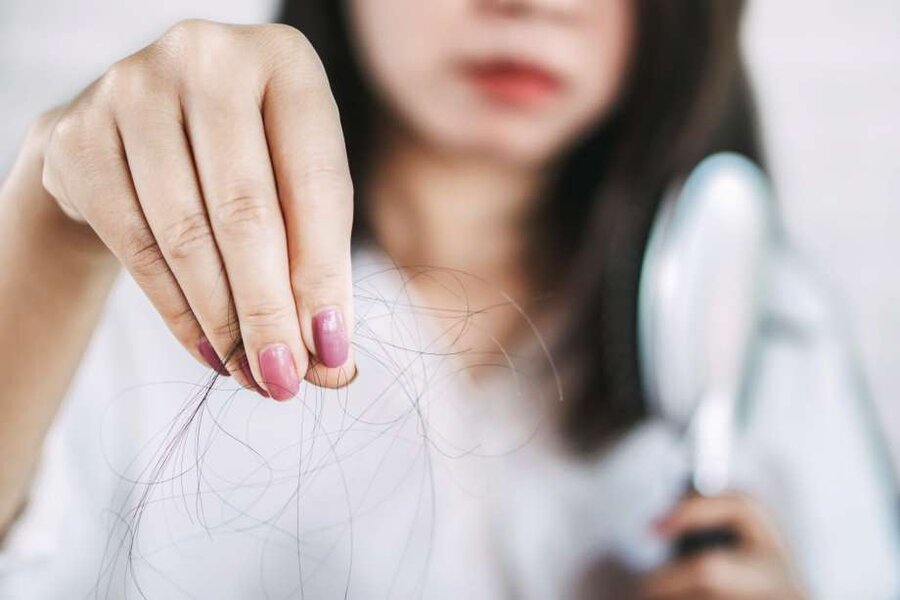 راهکارهایی که از ریزش موی سر جلوگیری می‌کند
