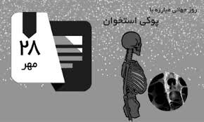 میزان شیوع پوکی استخوان در آذربایجانشرقی بالا است