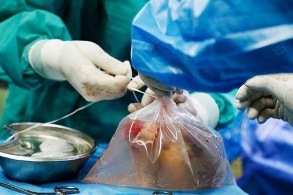 اهدای عضو معلم سمنانی به بیماران جان تازه بخشید