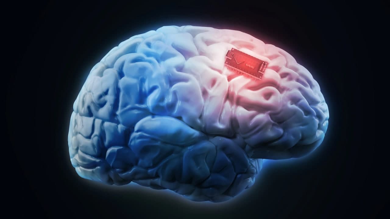 ایمپلنت مغزی جدید امکان تایپ کردن از طریق فکر کردن را فراهم می‌کند