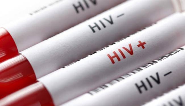 آخرین آمار مبتلایان به HIV در کشور اعلام شد