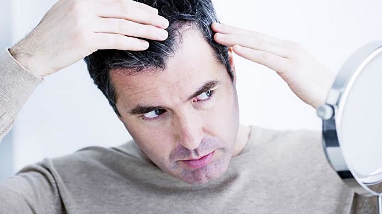 راهکارهایی برای مهار سفیدی زودرس موی سر