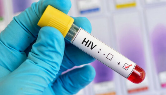 افزایش ۱۰ برابری ابتلاء زنان به ایدز