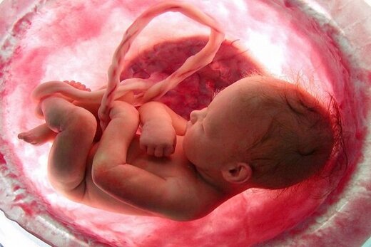 شرایط جدید غربال‌گری جنین اعلام شد: حاملگی پرریسک و به درخواست والدین