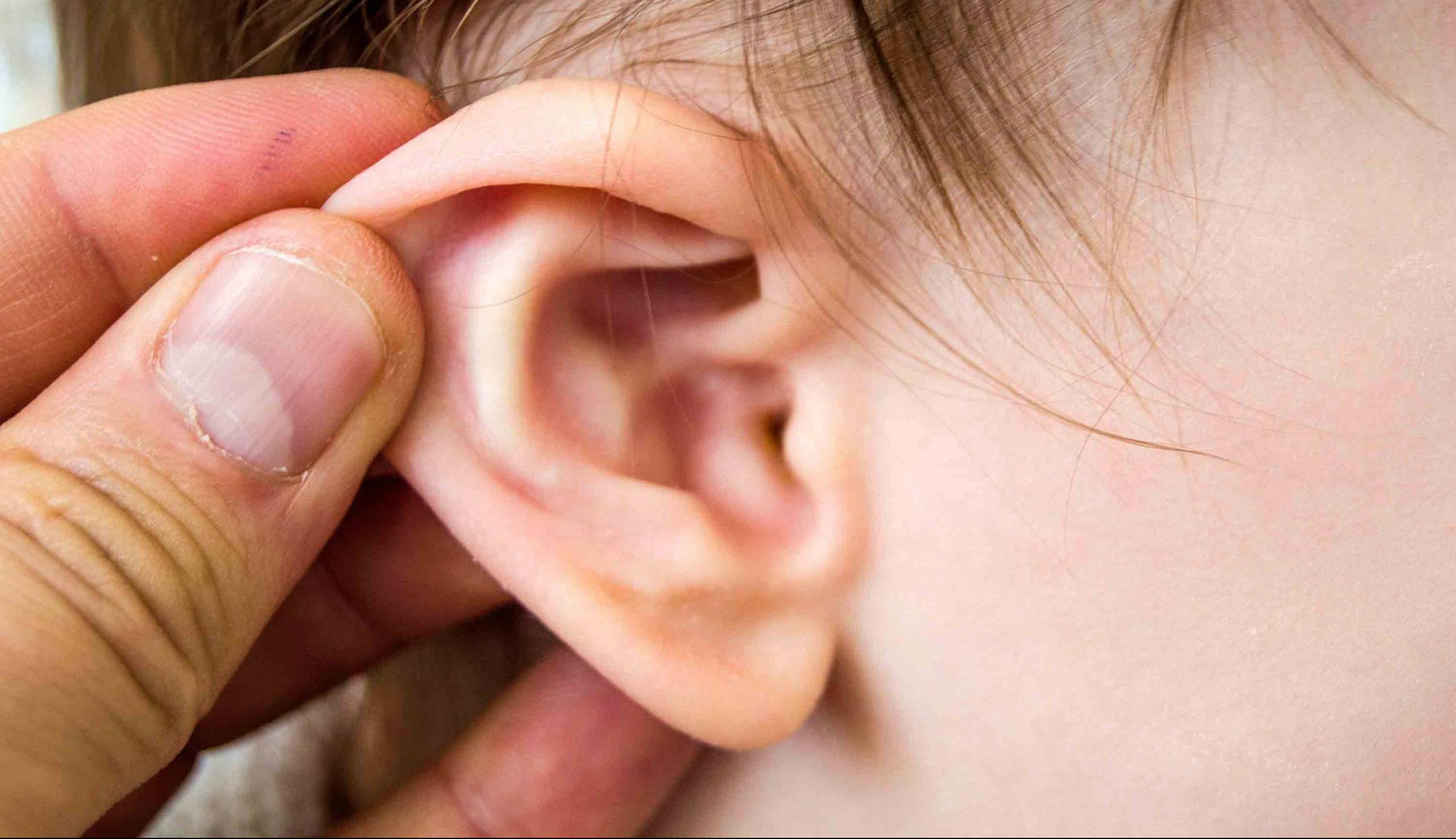 Как понять что у ребенка болят уши. Грибковый отит отомикоз. Наружный отит ушной раковины.