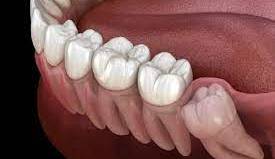  گوناگون/ 8 حقیقت دندانی که به احتمال زیاد نمی‌دانستید