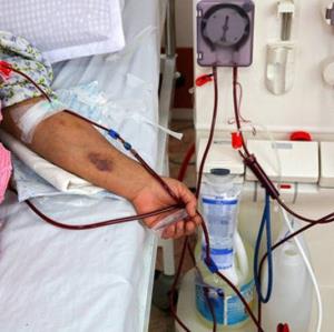 امید به زندگی بیماران دیالیزی در ایران؛ فقط ۳۰ درصد