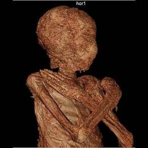 4گوشه دنیا/ حفظ جنین در بدن زن مومیایی ۲ هزار ساله!