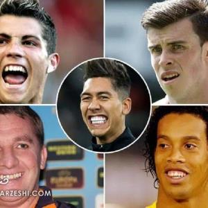 فوتبالیست‌هایی که دندان‌های‌شان را ترمیم کرده‌اند/ دندان بهتر، بازی بهتر!
