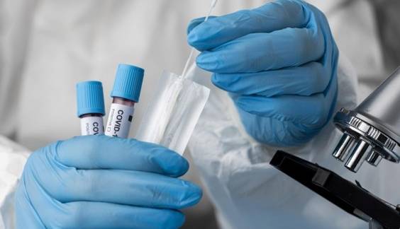 سرعت سرایت اومیکرون دو برابر آنفولانزا است