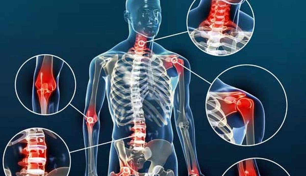 Медицинский боль. Боль это в медицине. Прогрессирующие боли в суставах. Профессиональный хруст мышц и костей.