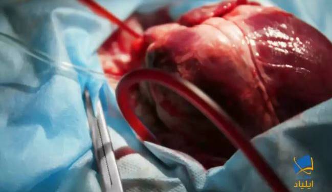 پیوند قلب خوک به انسان بدون ماده‌ای مافیایی امکان‌پذیر نبود!