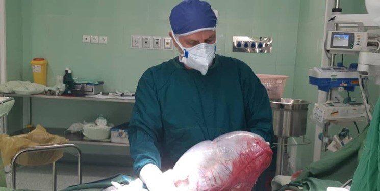 غده 8 کیلویی در شکم یک نوجوان؛ دختر ۱۳ ساله بخاطر سوءتفاهم جان باخت!