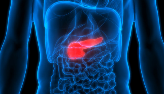 درمان سرطان پانکراس با نوعی ایمنی درمانی
