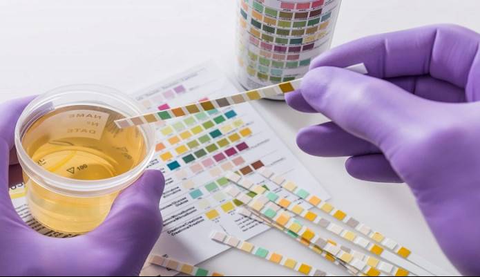 رفع عفونت ادرار در زنان به کمک داروی غیر آنتی بیوتیک