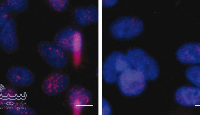 ابداع روش جدید پرتو درمانی برای درمان سرطان