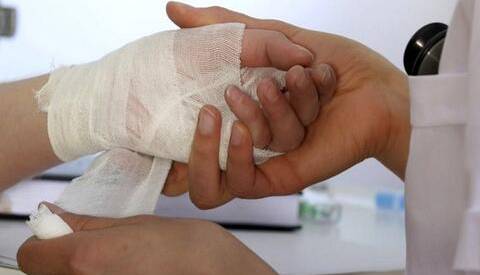 باورهای غلط درباره سوختگی