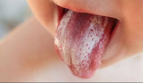 این میوه‌ها سبب سندروم حساسیت دهان می‌شوند  