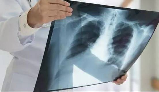 اولین دستگاه X-RAY تمام خودکار و بدون نیاز به رادیولوژیست معرفی شد