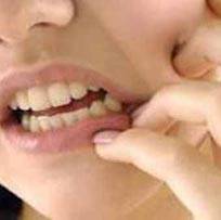 احکام/ مواد بی حسی دندانپزشکی روزه را باطل می کند؟