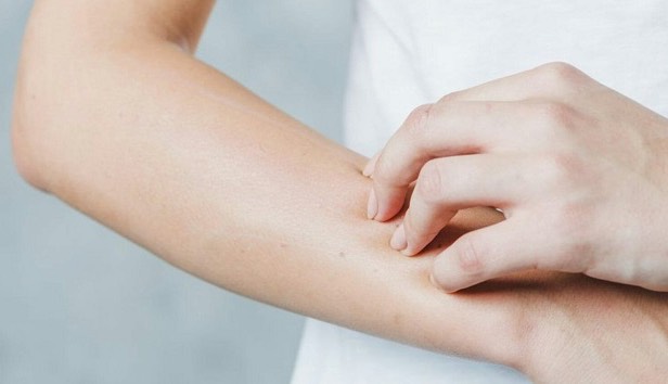 پشهها چه افرادی را نیش میزنند؟ پشهها چه افرادی را نیش میزنند؟