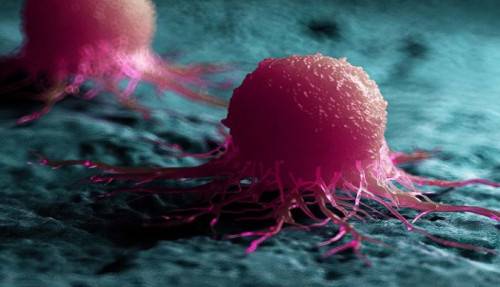 ویروس کشنده سلول های سرطانی یافت شد