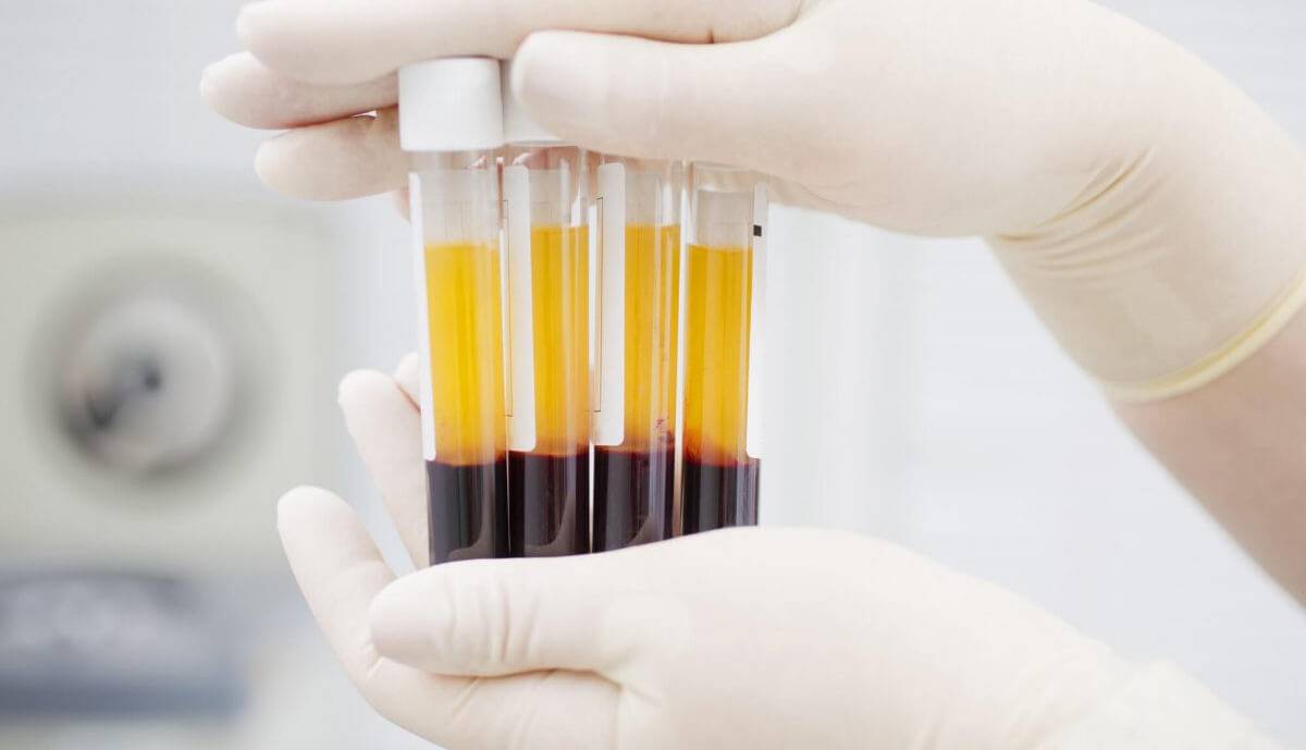 پلاسمافروشی مورد تایید نیست