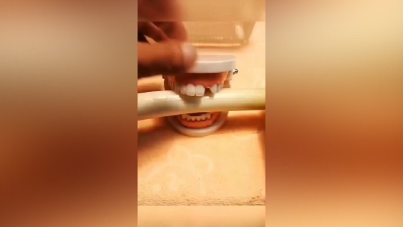 نمونه‌ای جالب و دیدنی از پیشرفت‌های حوزه دندان پزشکی