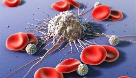 نشانه‌های سرطان خون چیست؟
