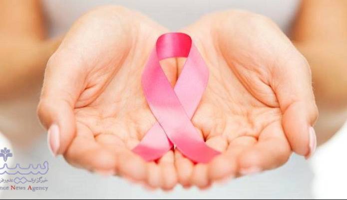 این ژن سرطان پستان را مرگبار می کند
