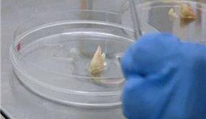 تولید مینای بیولوژیکی دندان به کمک سلول‌های بنیادی