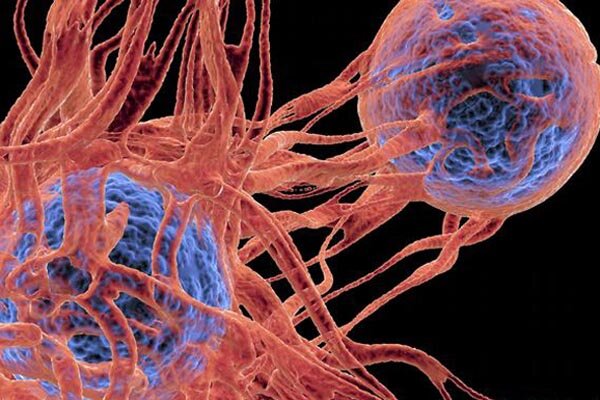 مهم‌ترین عامل سرطان در ایران