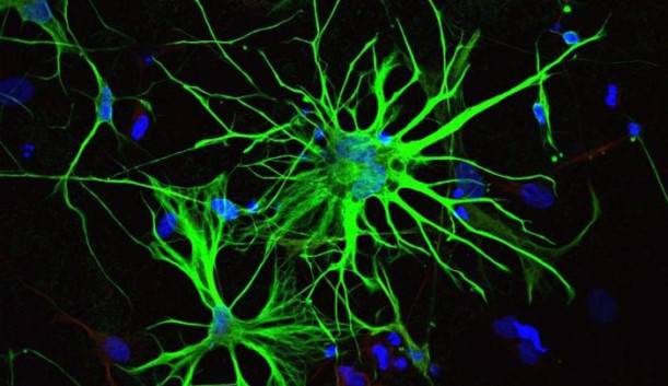 کشف عملکردی نو در بیش از نیمی از سلول های مغزی