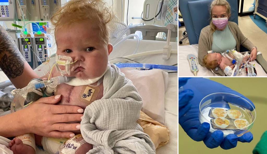 نوزاد آمریکایی با اولین پیوند قلب و تیموس در تاریخ پزشکی ماندگار شد