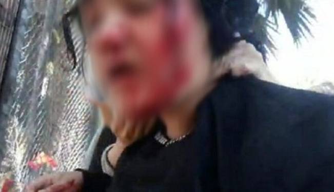 ضرب و شتم پناهجویان افغانستانی توسط پلیس ترکیه
