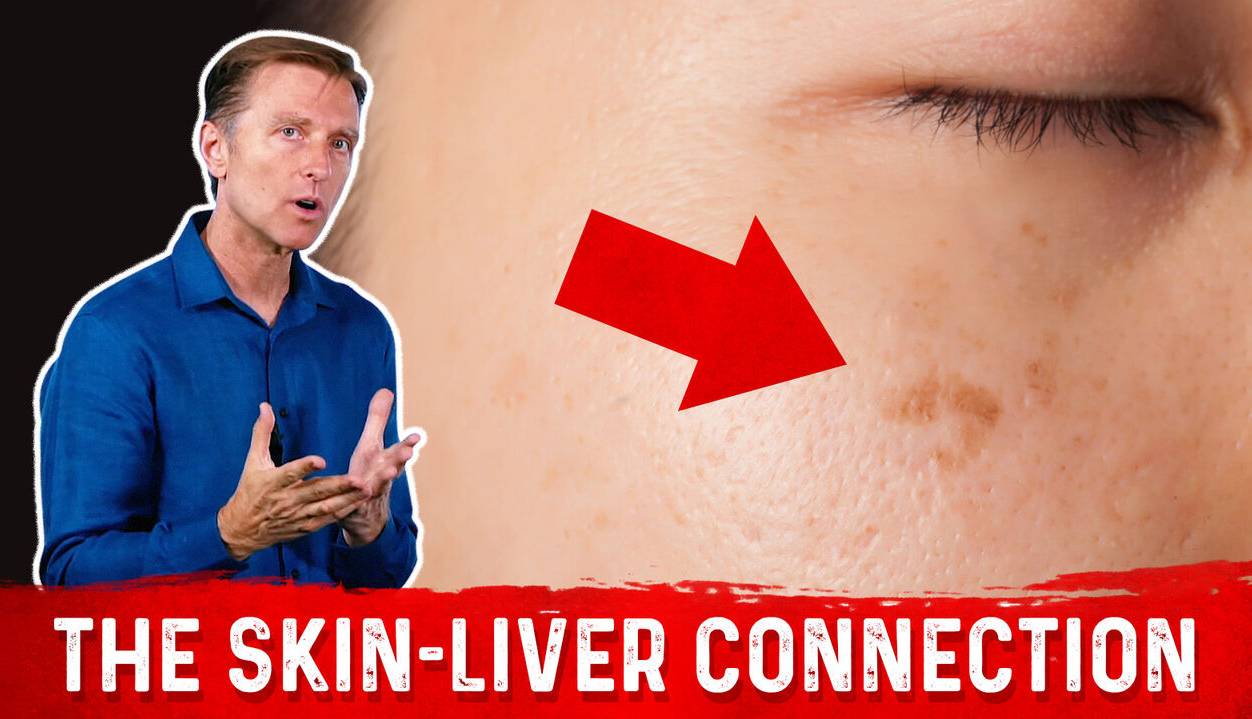 این چهار تغییر پوستی نشان می‌دهد کبد بیماری دارید  