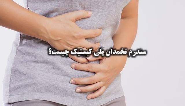 سندرم تخمدان پلی کیستیک چه علائمی دارد؟