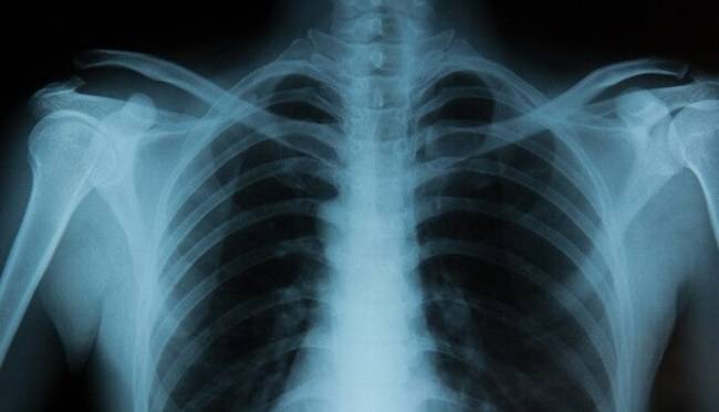 تشخیص هویت نژادی از روی تصاویر اشعه ایکس با هوش مصنوعی