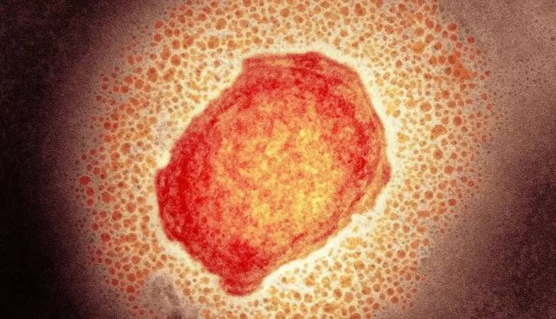 آبله میمون چیست؟