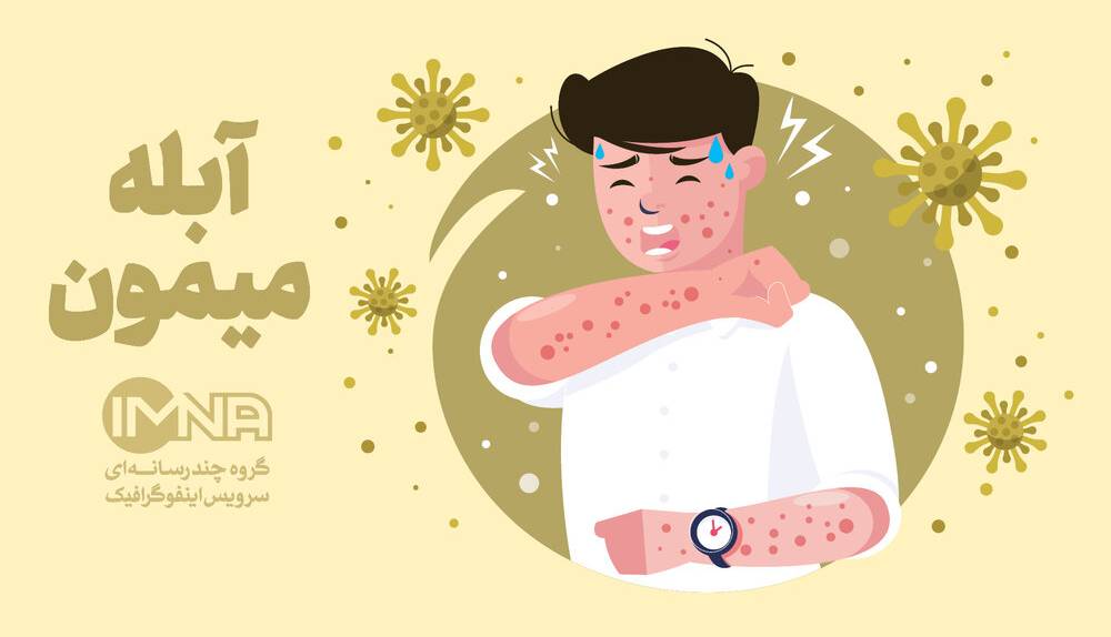 اینفوگرافی؛ همه چیز درباره آبله میمونی