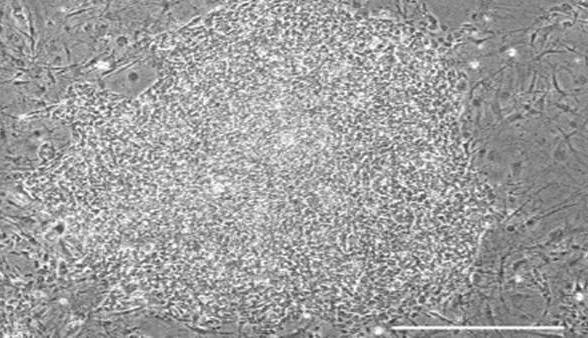 یافته‌های جدید پژوهشگران برای درمان HIV از طریق سلول‌های بنیادی