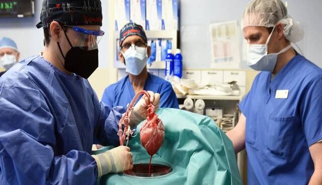 دلیل مرگ مردی که از خوک قلب دریافت کرد، چه بود؟