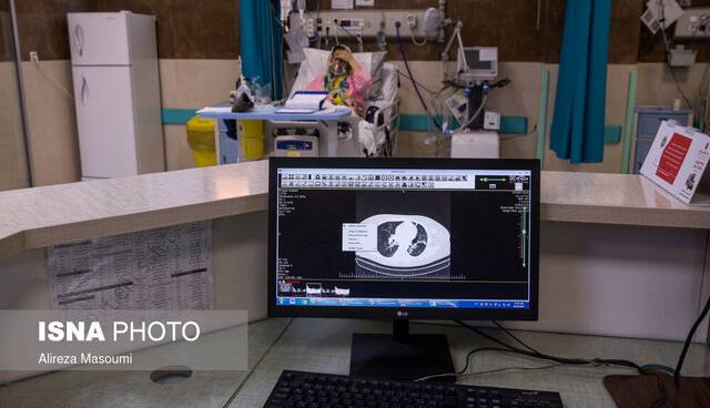 شناسایی 103 مبتلای جدید کرونایی در کشور؛ 4 بیمار دیگر جان باختند