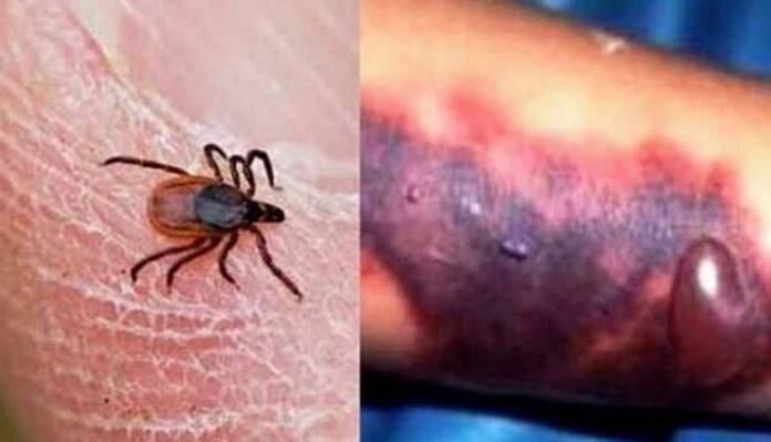 بیماری بسیار کشنده، اما قابل پیشگیری