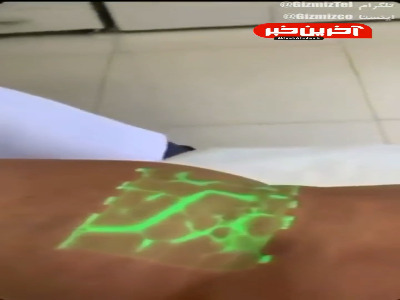 یه وسیله کاربردی برای تزریق و پیدا کردن رگ