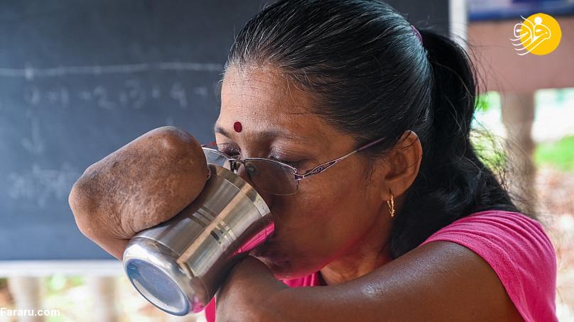 خانم معلم هندی با دست‌ها و پاهای قطع شده!